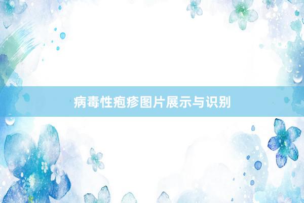 病毒性疱疹图片展示与识别